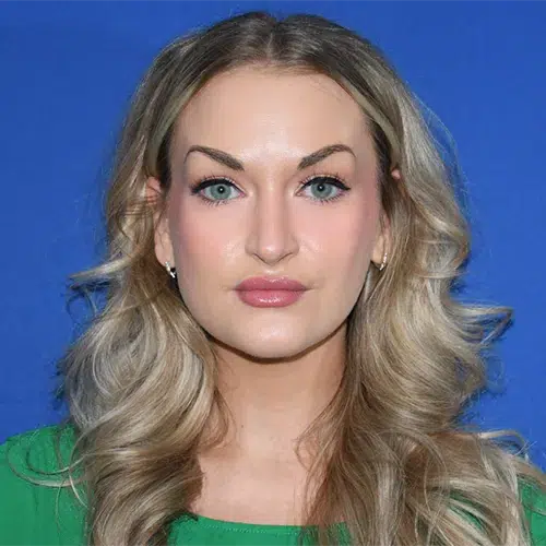 Patient 05, front view after rhinoplasty