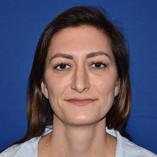 Patient 20, view 1 view after rhinoplasty