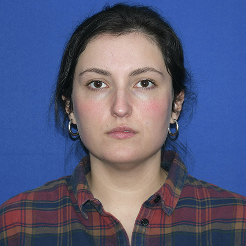 Patient 21, front view before chin liposuction