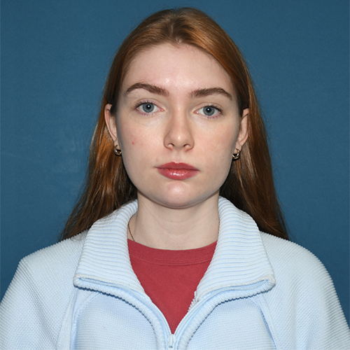 Patient 19, front view before chin liposuction
